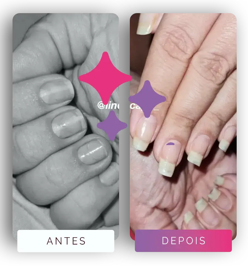 (LindaCaps) Página - Antes_Depois #1